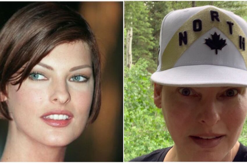 Linda Evangelista, ex top-model: “La criolipolisi mi ha sfigurata, vivo da reclusa”