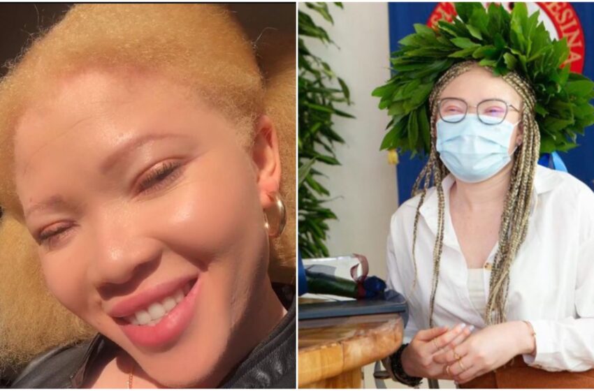 Rapita, violentata e venduta poiché albina in Nigeria, diventa dottoressa a Trento